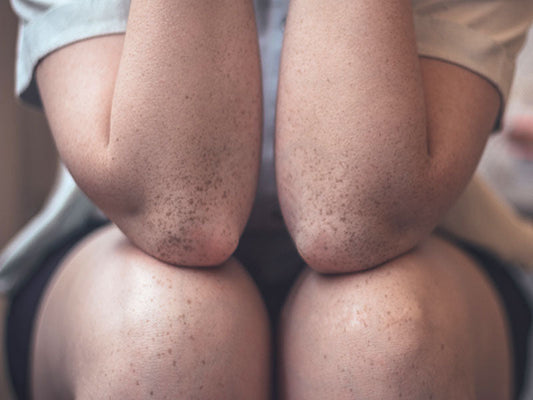 How Beef Organ Meats Can Support Healthy Skin