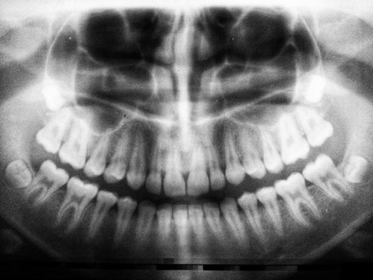 vitamin k2 for healthy teeth